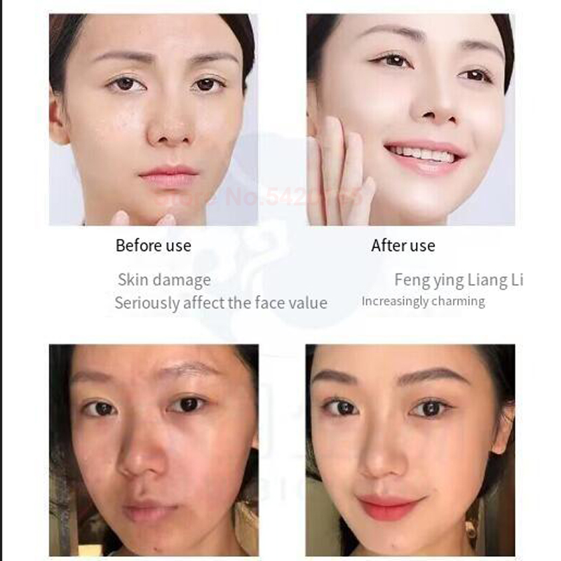 0.25 mm Microneedle GHK-Cu Blu - Valerian Root Capsule review and price